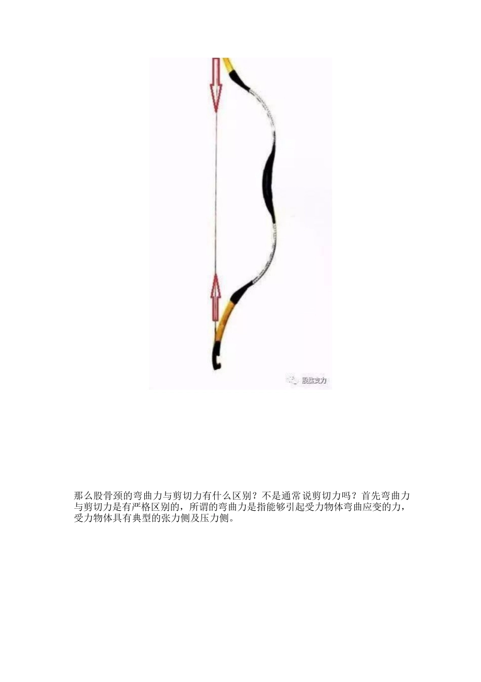弯曲力原理及其在骨科领 域的应用_第11页