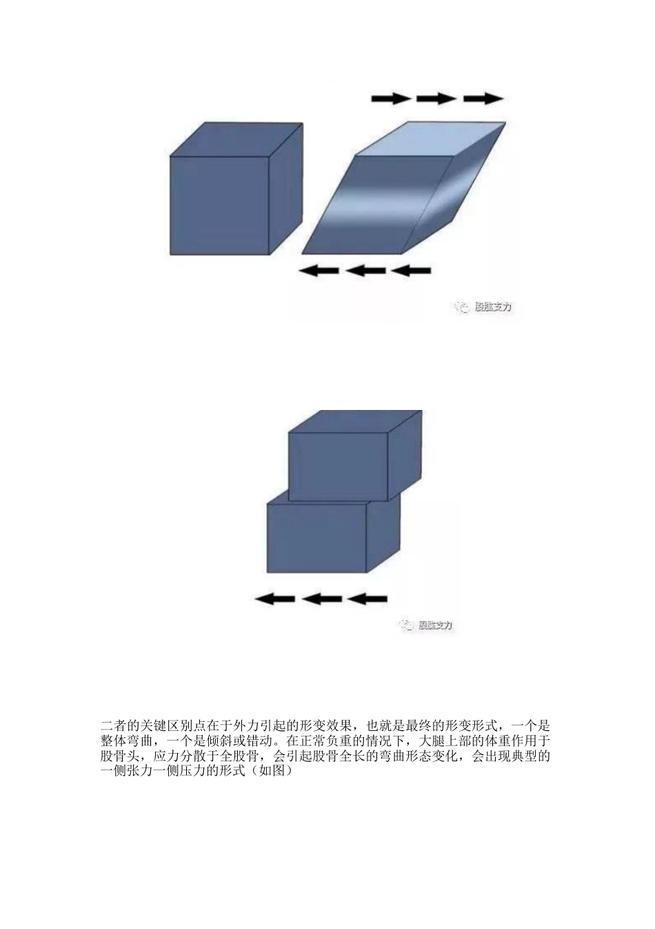 弯曲力原理及其在骨科领 域的应用_第13页