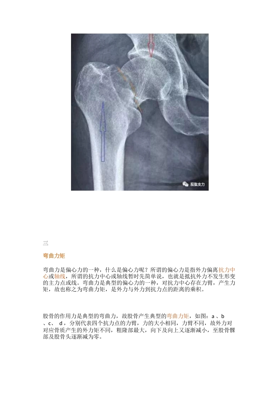 弯曲力原理及其在骨科领 域的应用_第15页