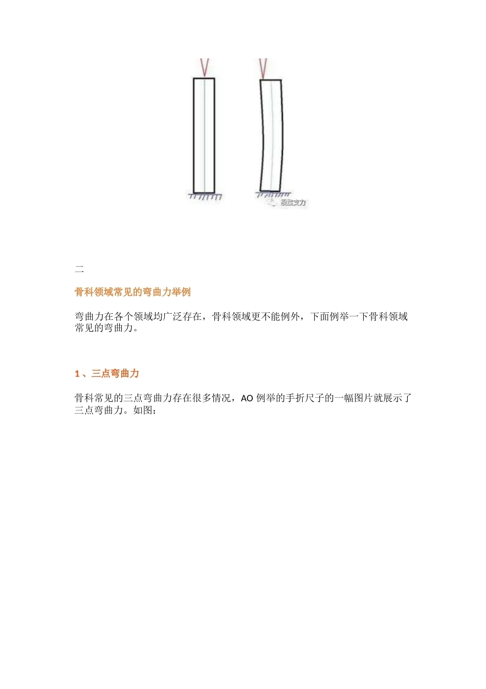 弯曲力原理及其在骨科领 域的应用_第4页