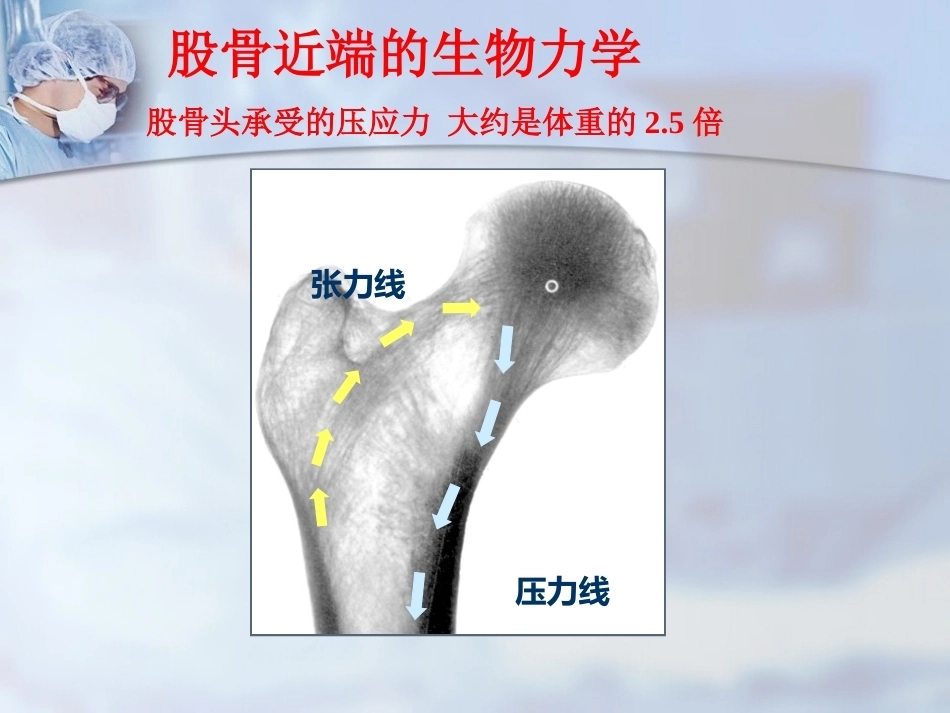 股骨转子间骨折的治疗：髓内or髓外_第5页