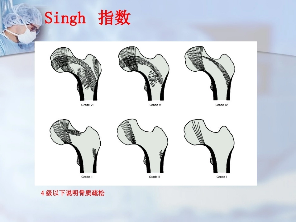 股骨转子间骨折的治疗：髓内or髓外_第7页