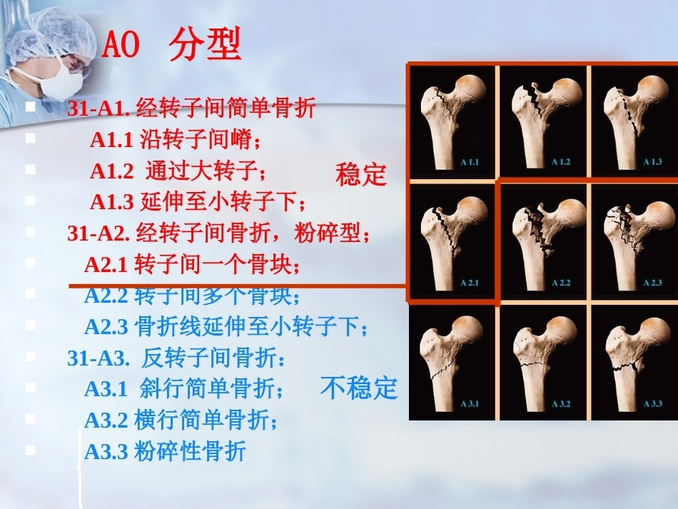 股骨转子间骨折的治疗：髓内or髓外_第9页