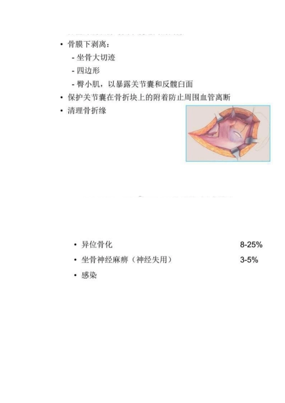 髋部骨折的手术入 路及步骤_第12页