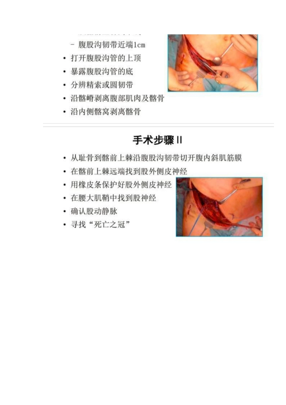 髋部骨折的手术入 路及步骤_第4页