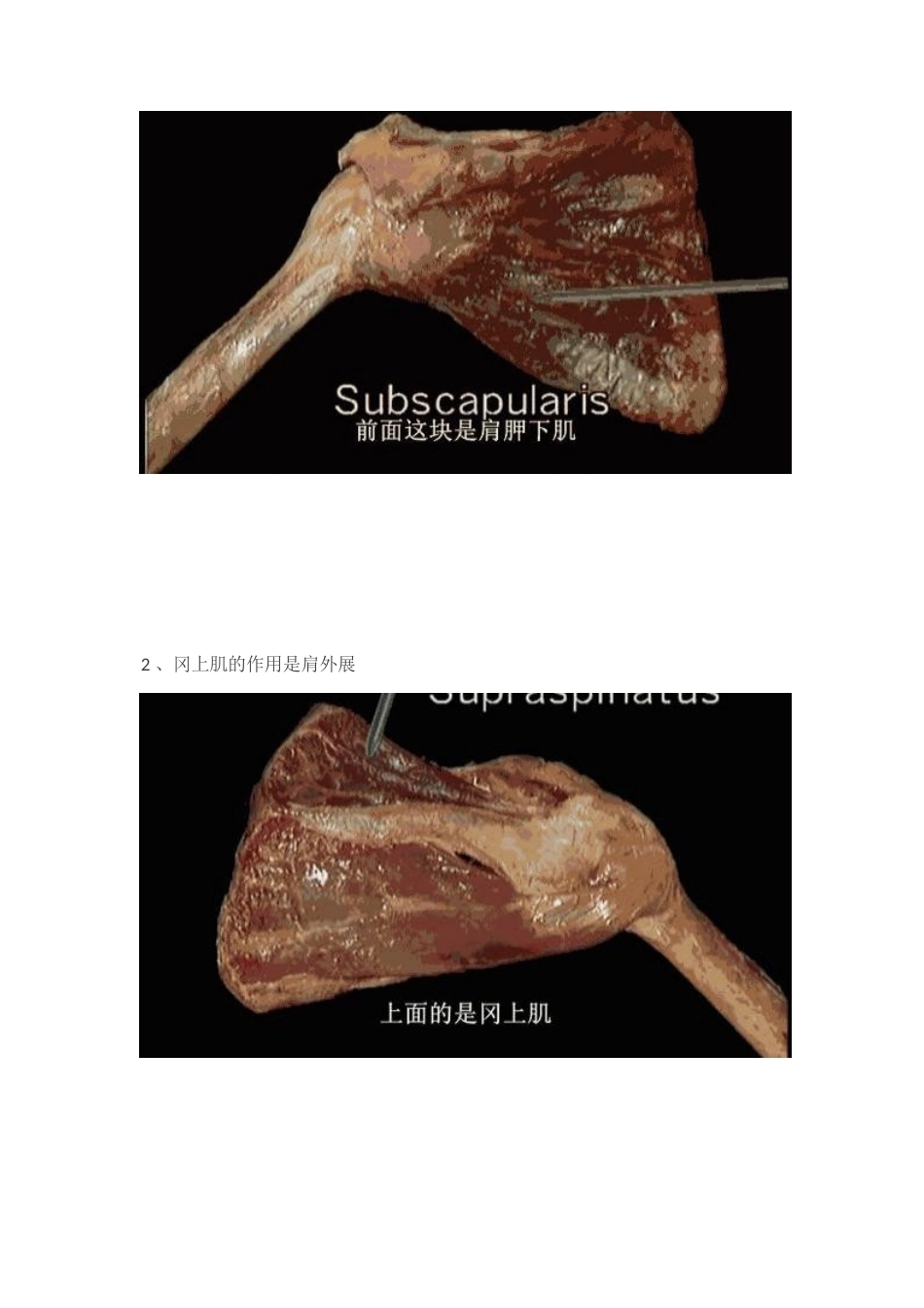 肩袖损伤的诊 断和治疗_第3页