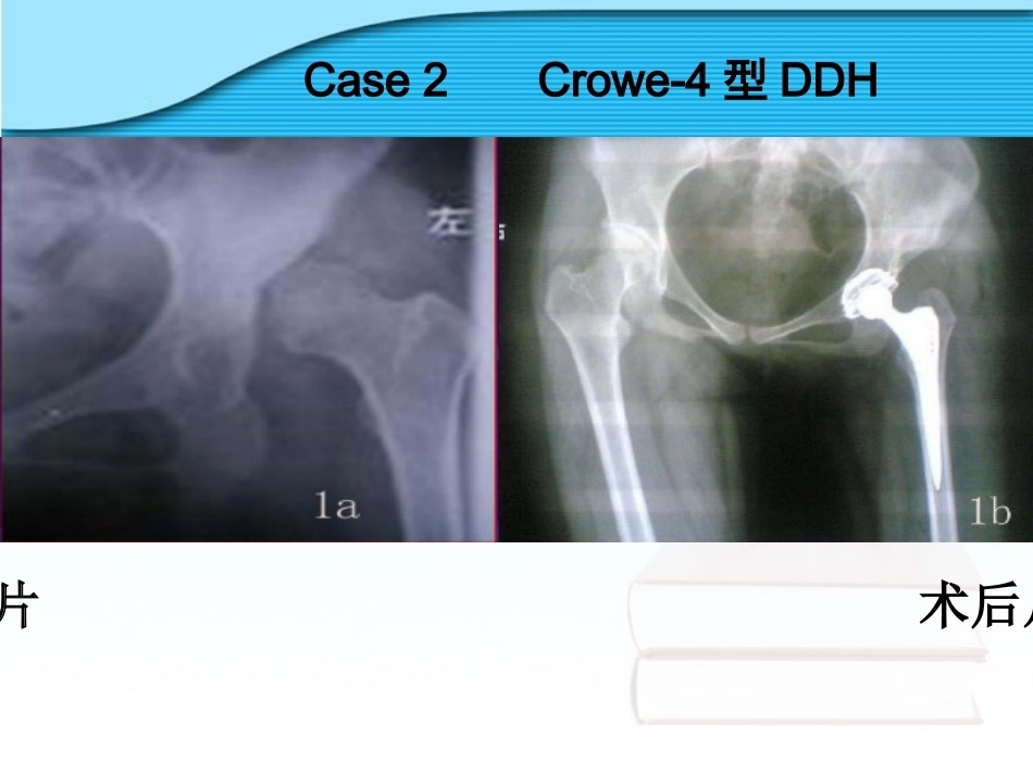 螺旋臼要 点_第12页