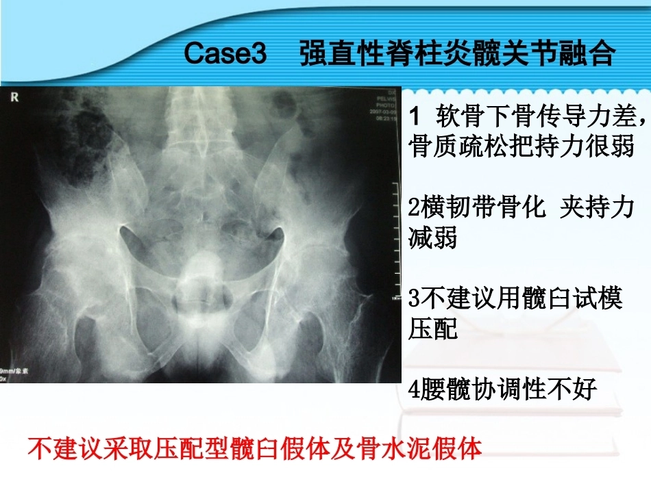 螺旋臼要 点_第14页