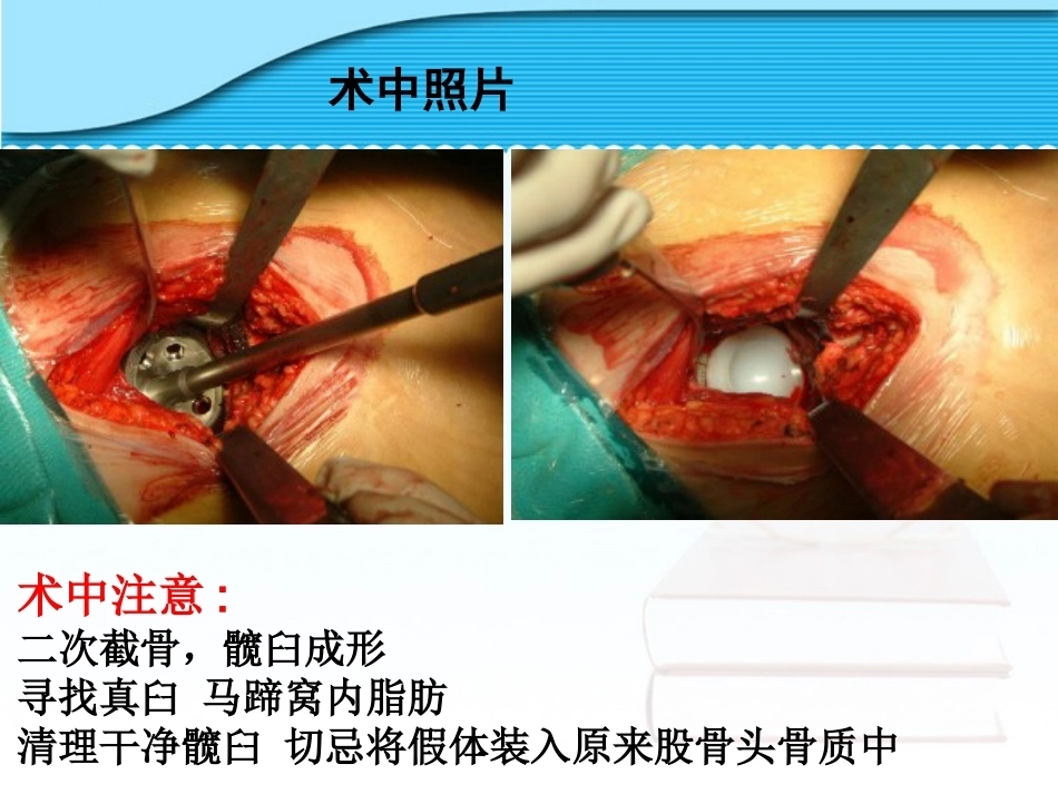 螺旋臼要 点_第15页
