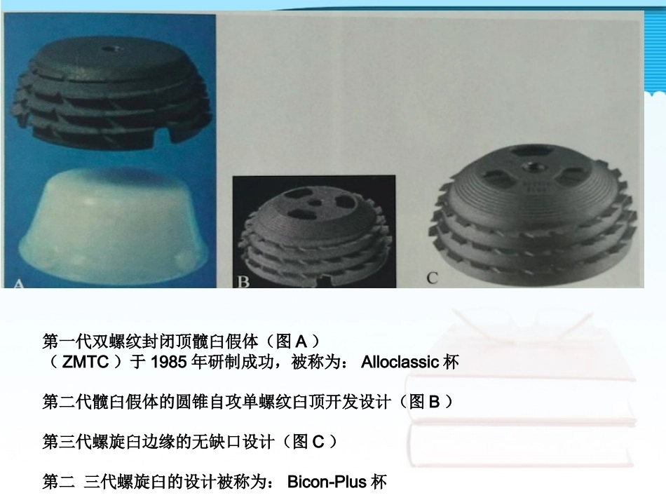 螺旋臼要 点_第6页