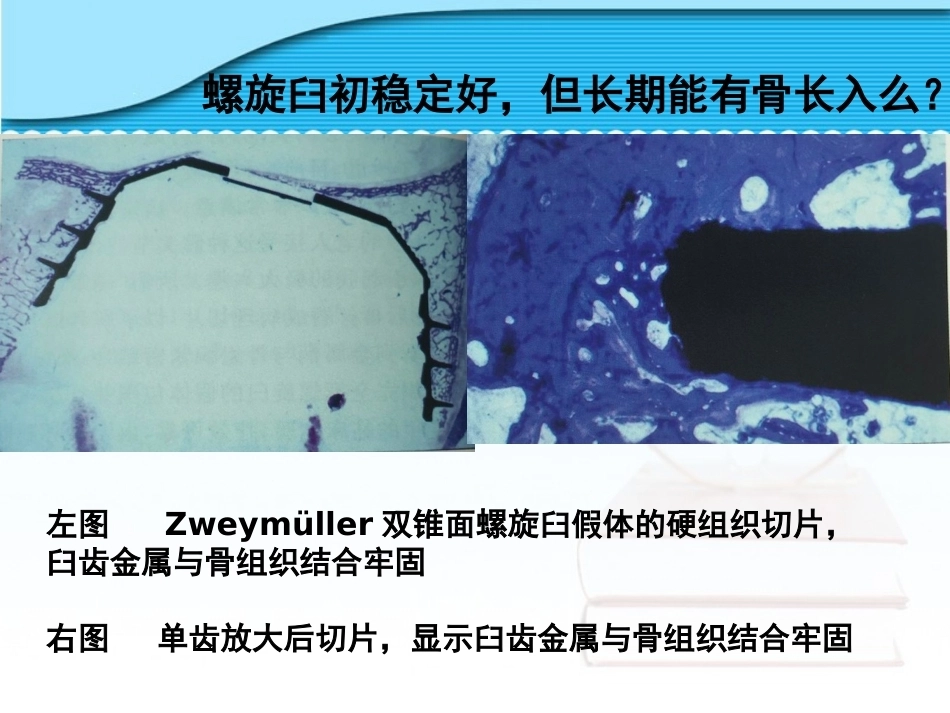 螺旋臼要 点_第9页