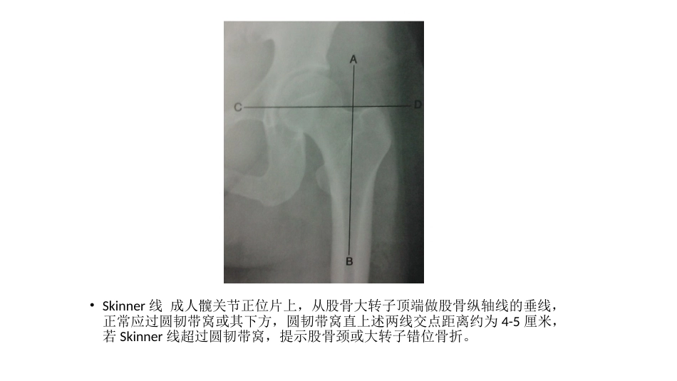 髋关节角度 测量_第6页