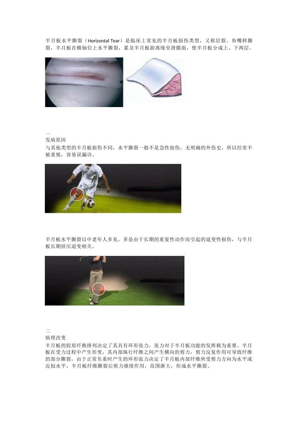 半月板水平撕裂的临床 诊治技巧_第1页