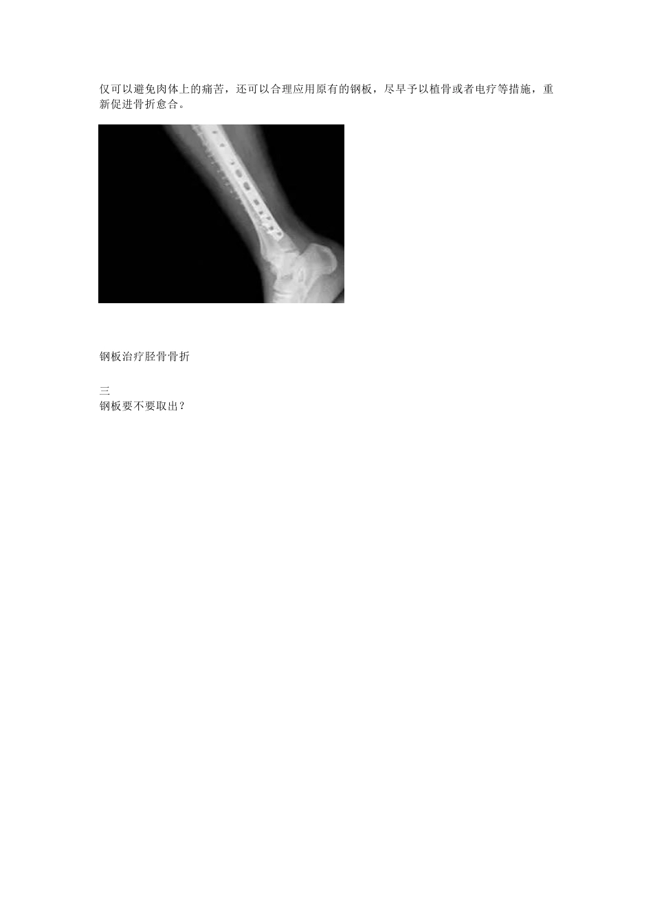 装了钢板，一定要取吗_第3页