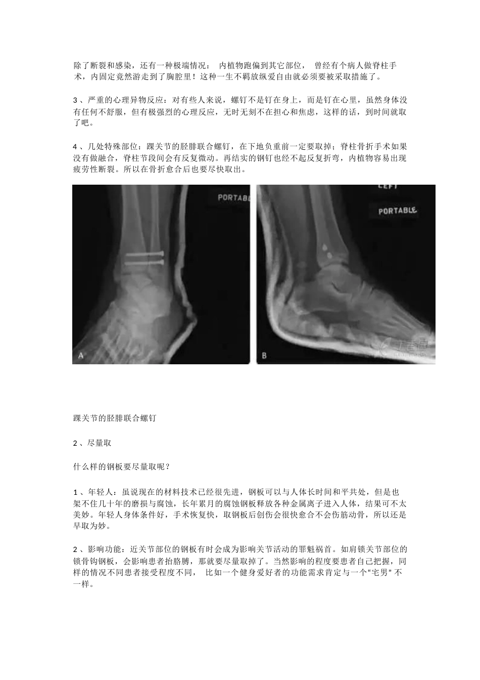 装了钢板，一定要取吗_第5页