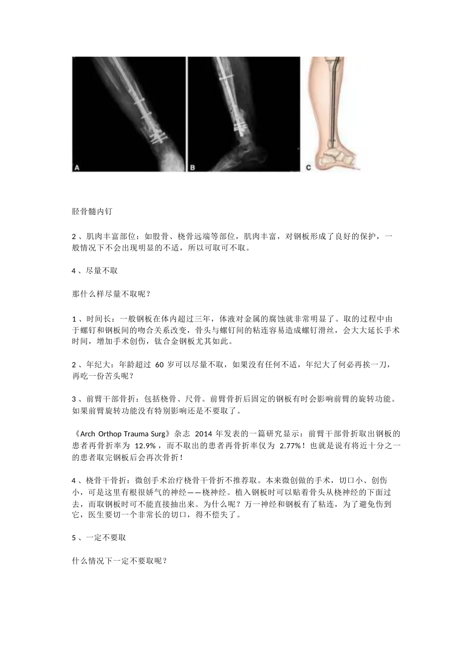 装了钢板，一定要取吗_第7页