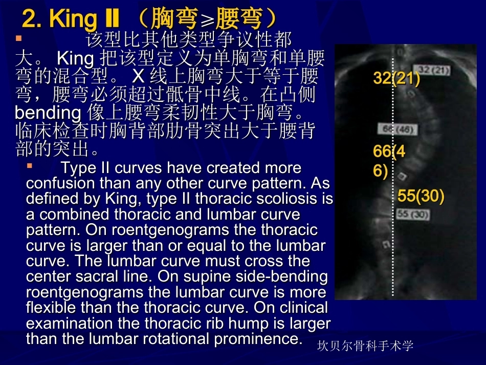 青少年特发性脊柱侧弯的分型_第15页