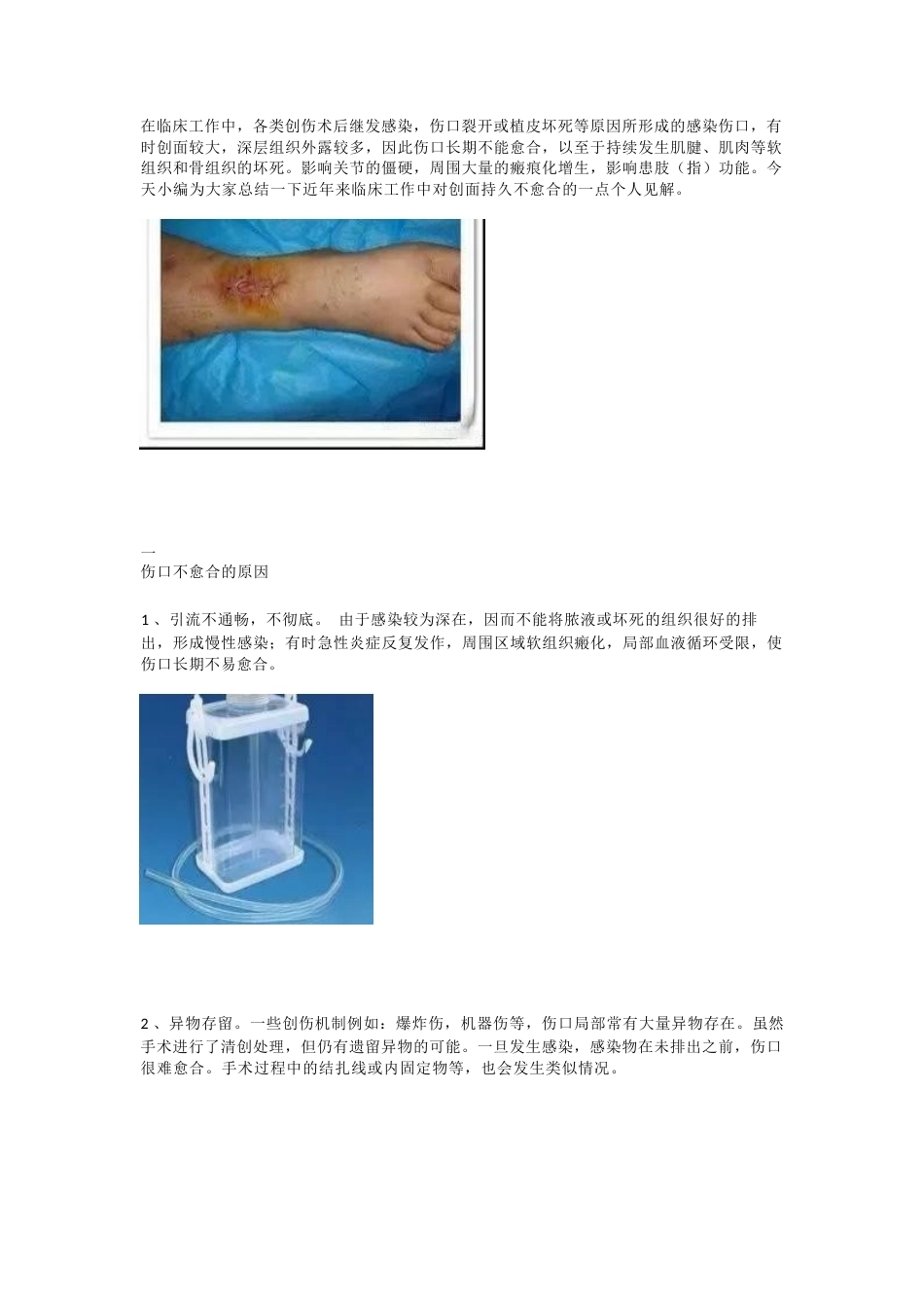 创面持久不愈合的原 因及治疗策略_第1页