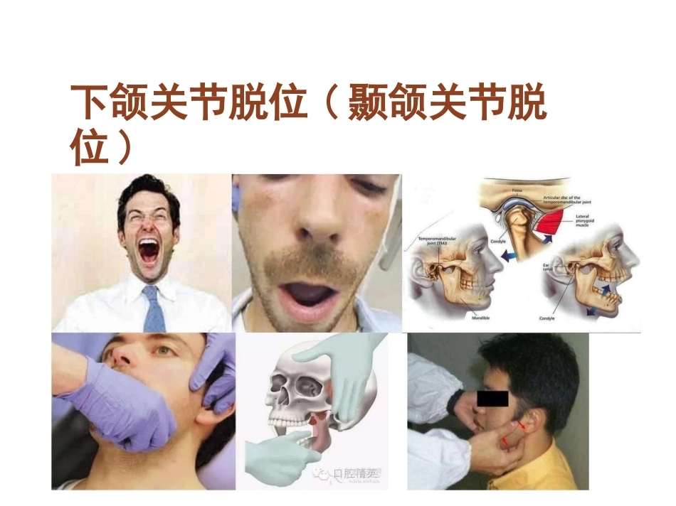 骨科体 格检查_第10页