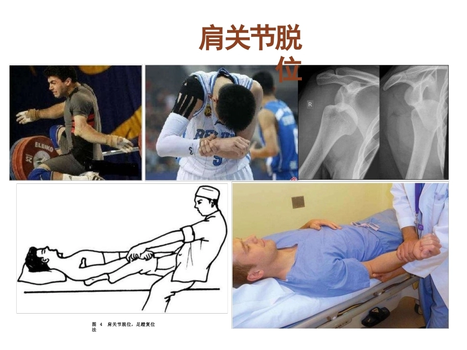骨科体 格检查_第11页