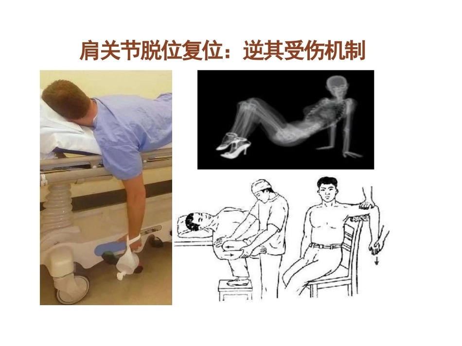 骨科体 格检查_第12页