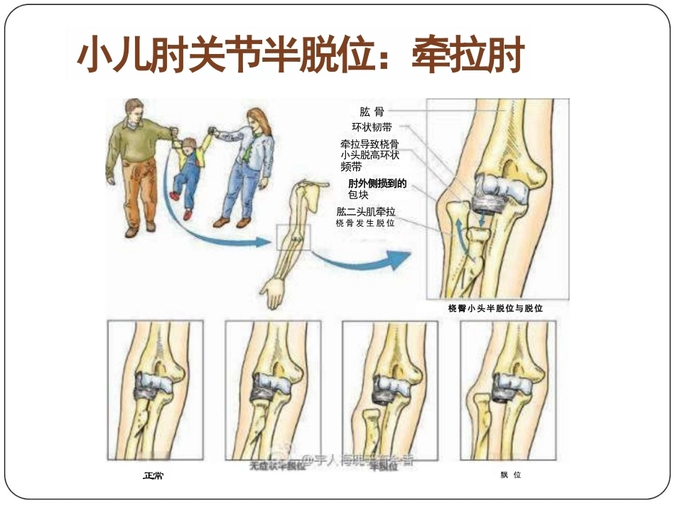 骨科体 格检查_第13页