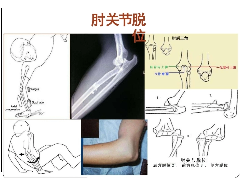 骨科体 格检查_第14页