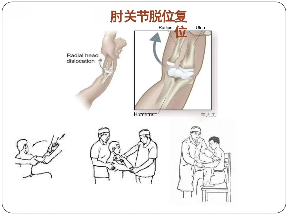 骨科体 格检查_第15页