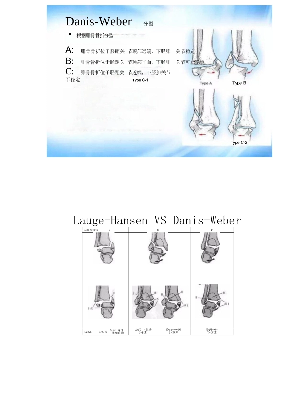 踝关节骨折的分型及治疗_第14页