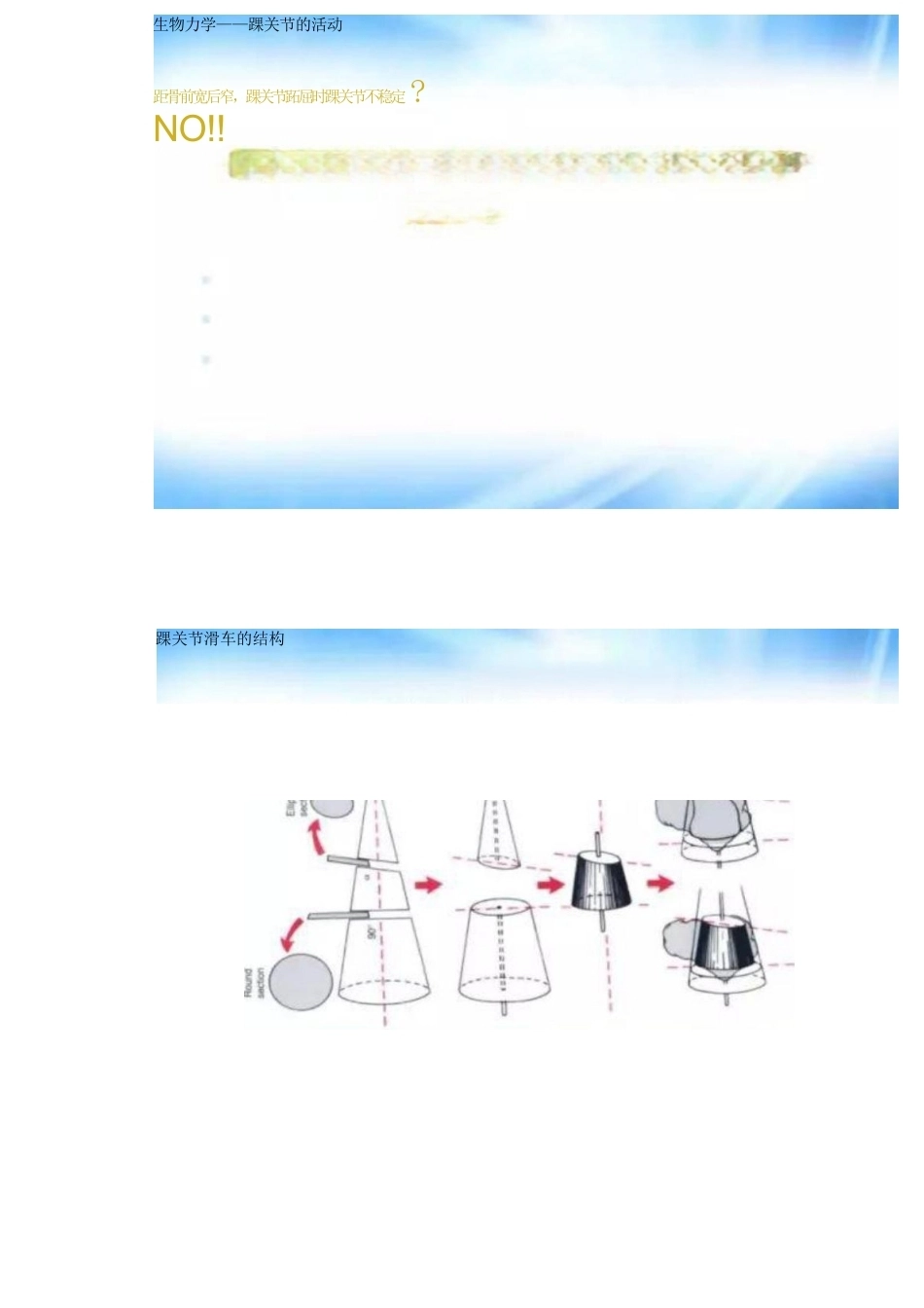 踝关节骨折的分型及治疗_第3页