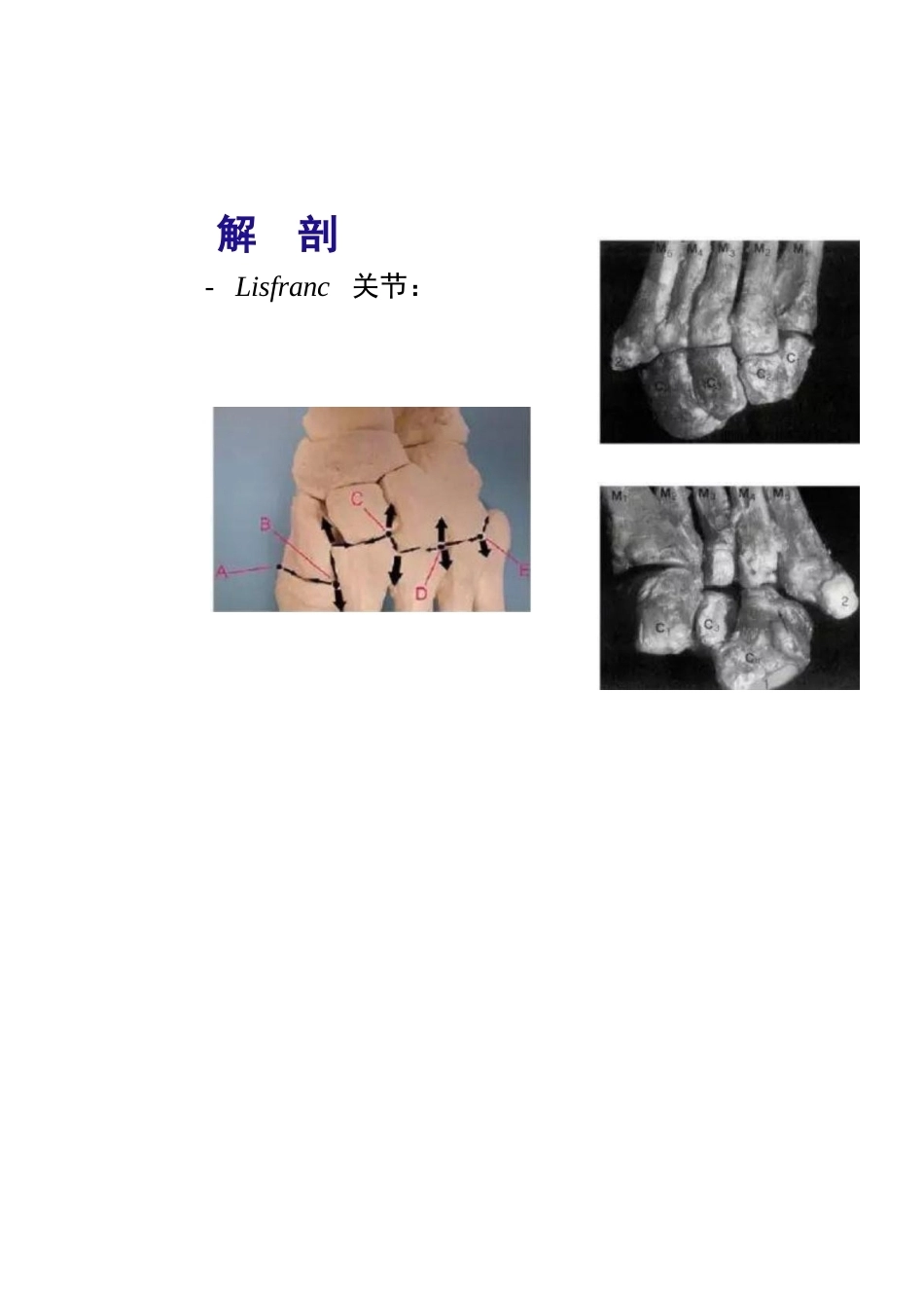 跖跗关节Lisfranc损伤的治疗_第5页