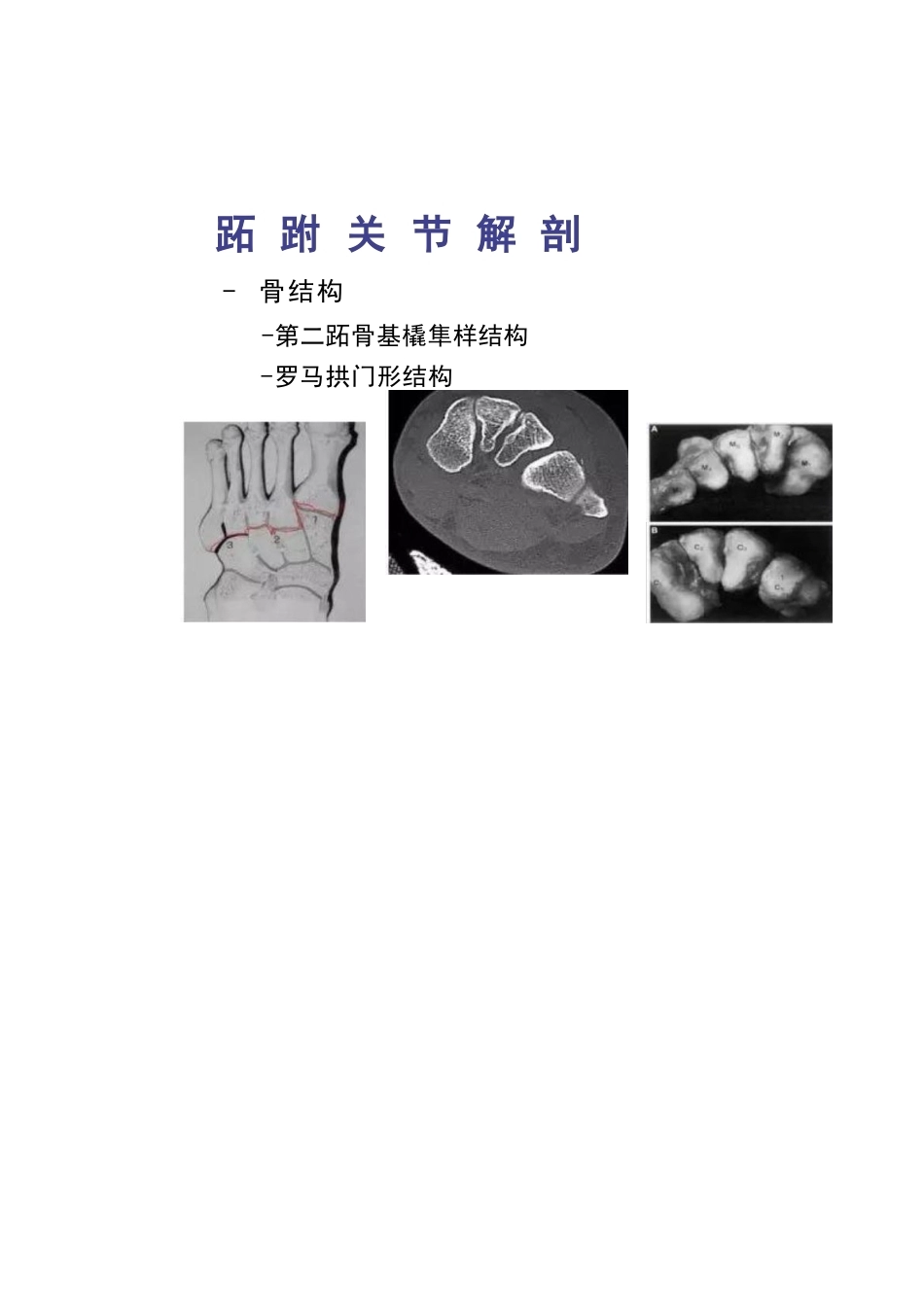 跖跗关节Lisfranc损伤的治疗_第6页