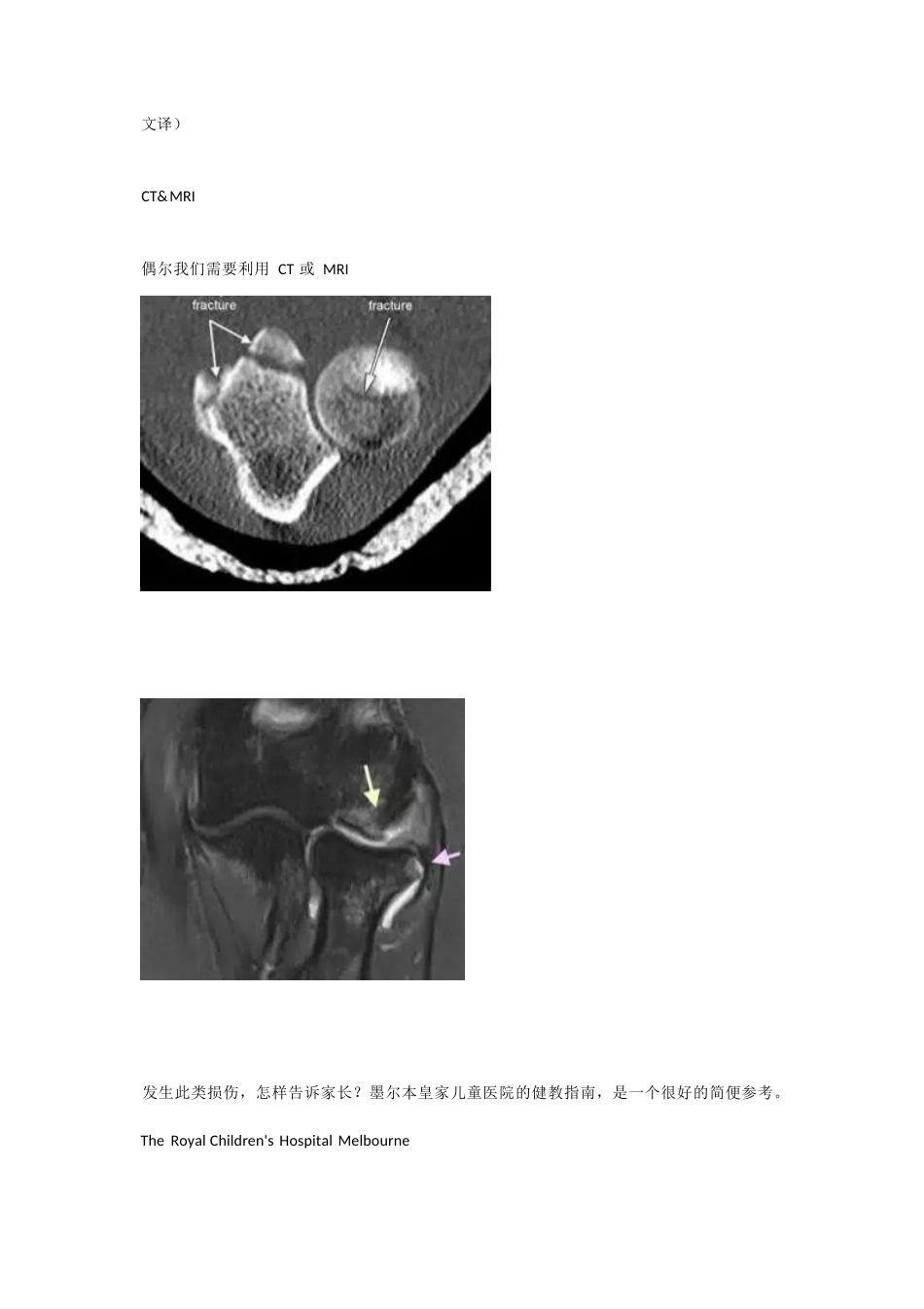 儿童桡骨头、颈骨折分型_第10页