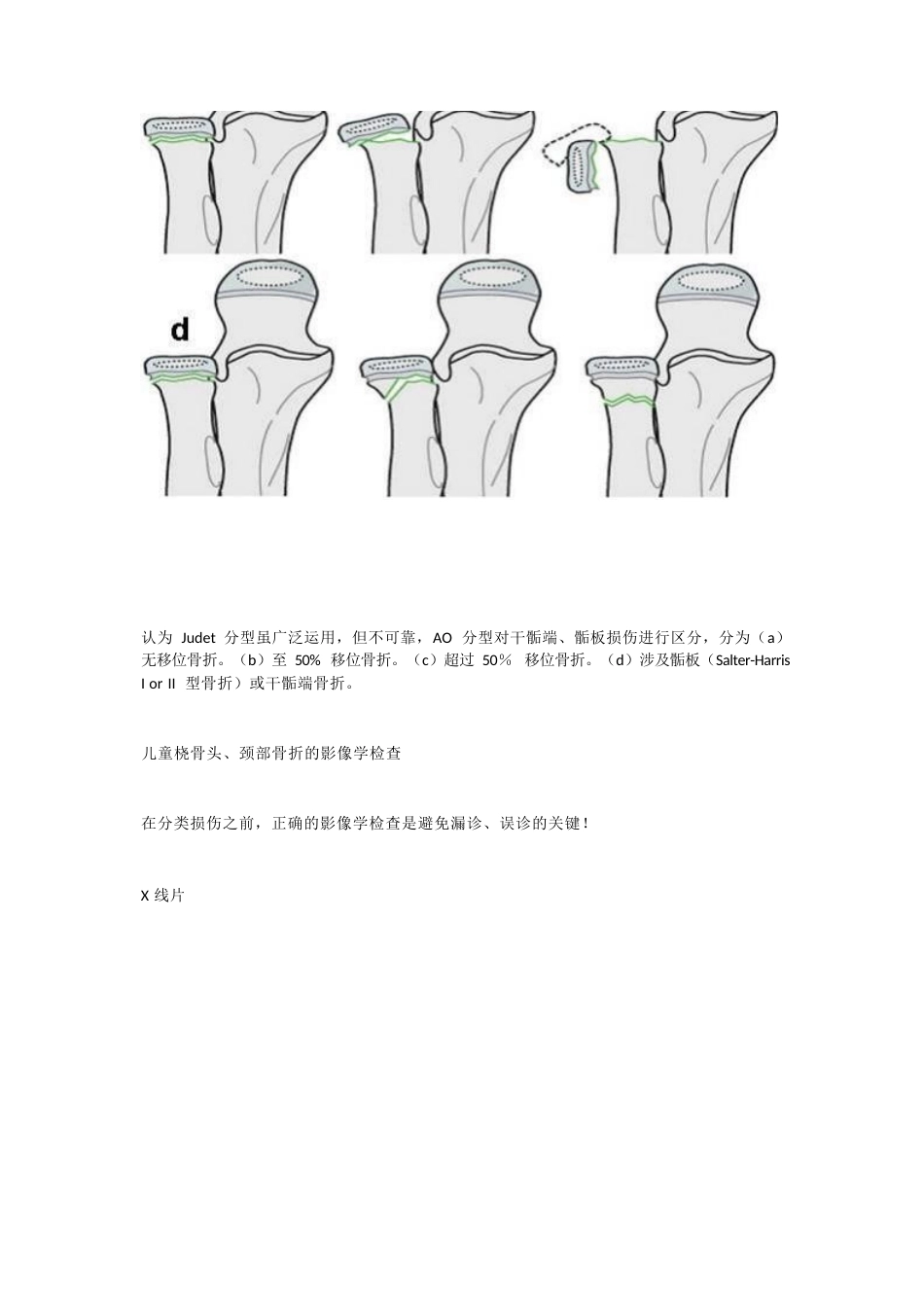 儿童桡骨头、颈骨折分型_第6页