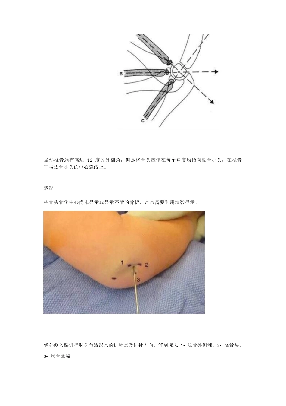 儿童桡骨头、颈骨折分型_第8页
