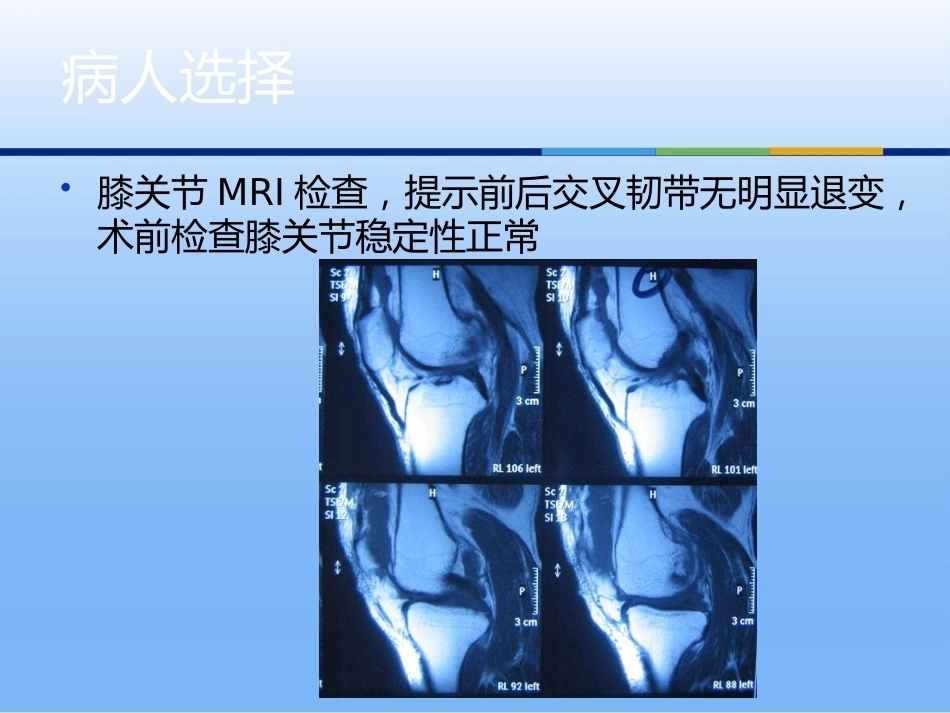 膝关节单髁 置换二_第6页
