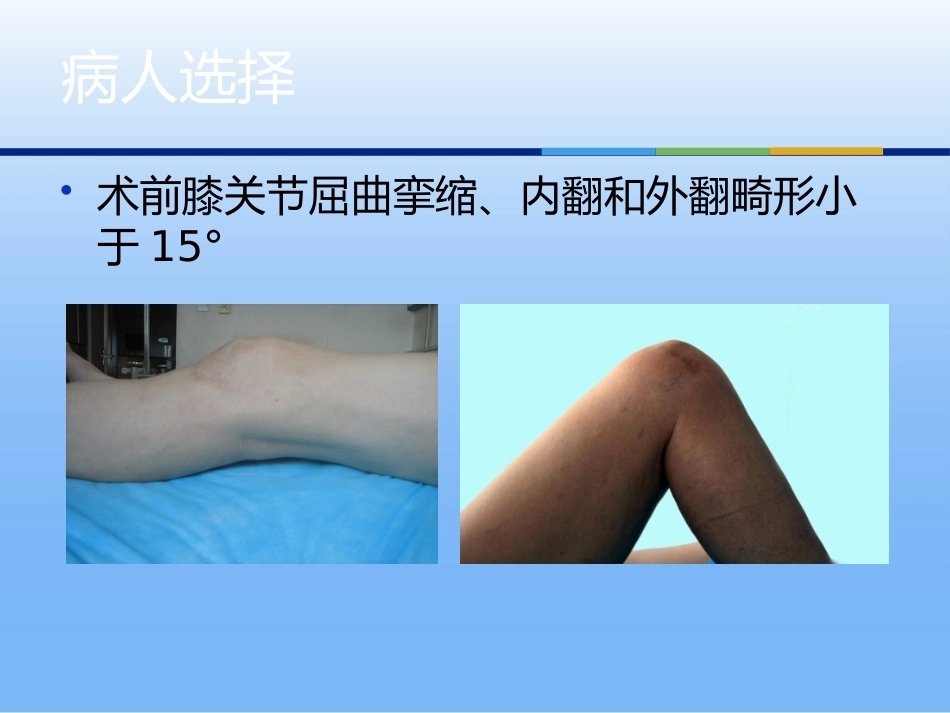 膝关节单髁 置换二_第7页