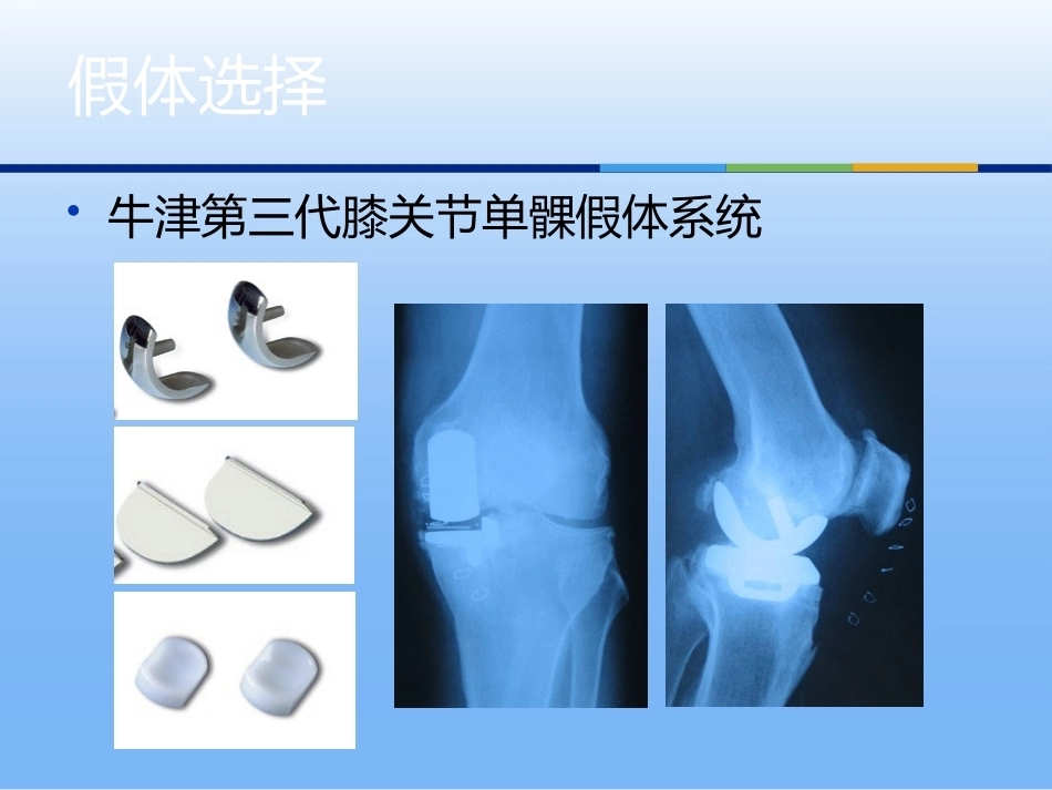 膝关节单髁 置换二_第8页