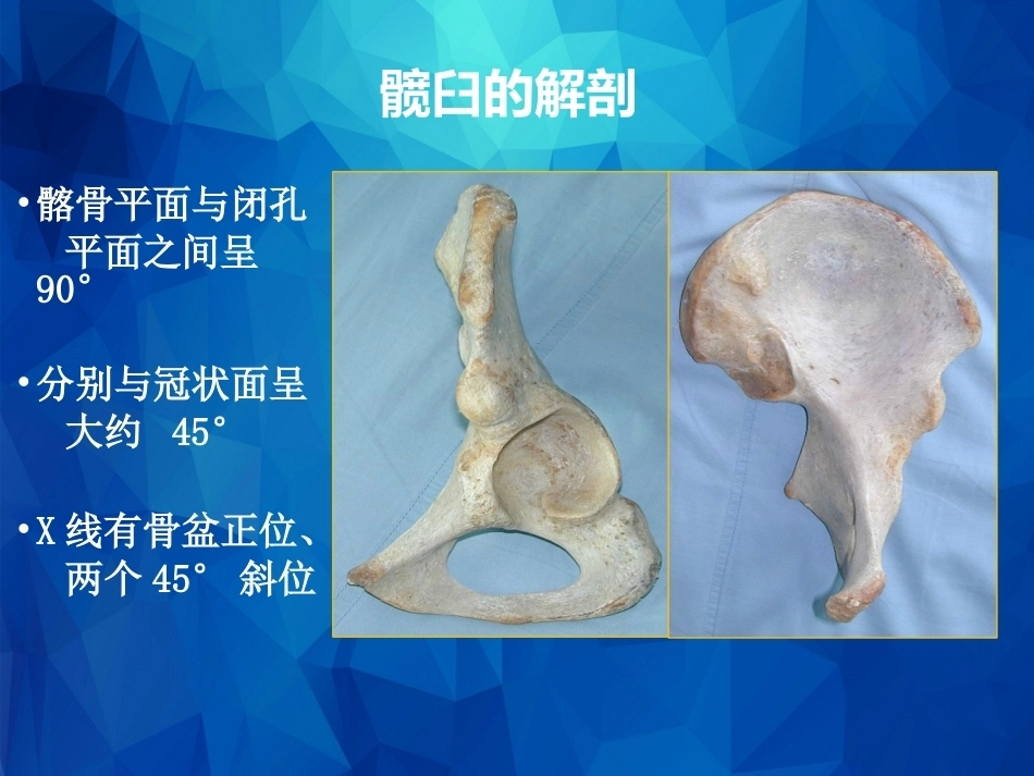 Stoppa及其改良入路的简介及临床应用_第3页