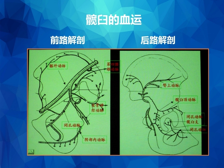 Stoppa及其改良入路的简介及临床应用_第5页