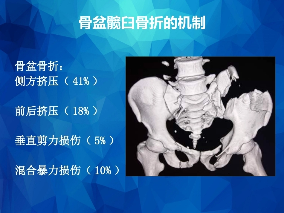 Stoppa及其改良入路的简介及临床应用_第7页