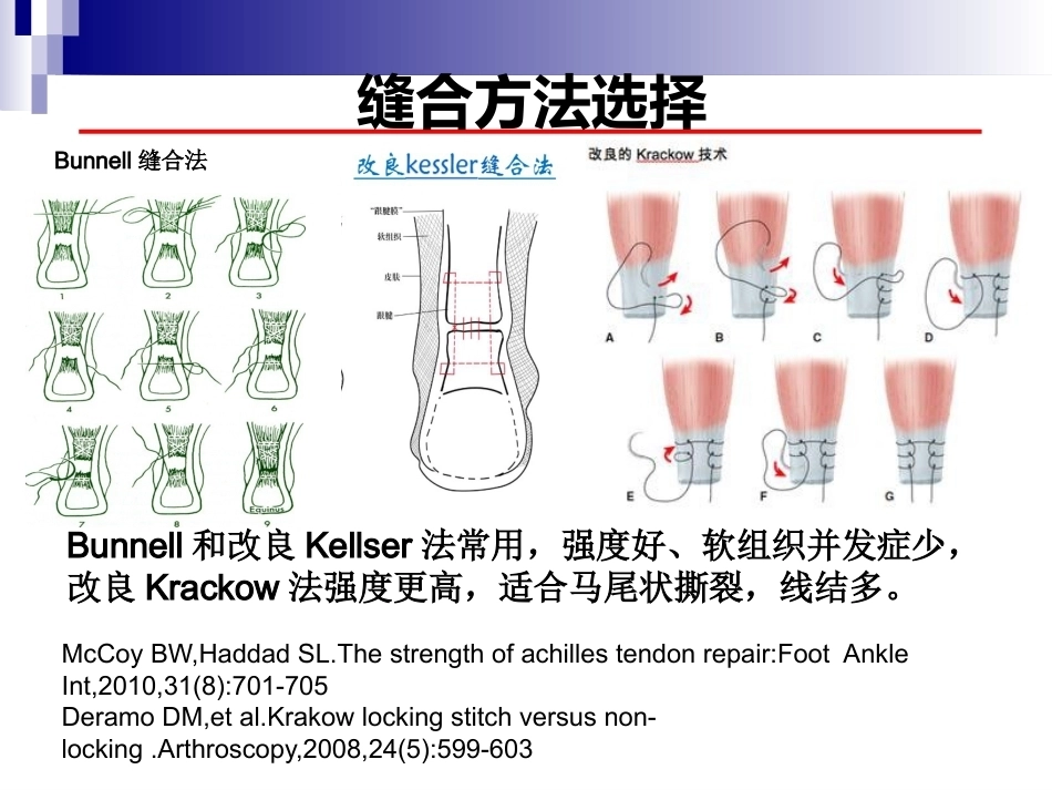 急性跟腱中部断裂的诊 治_第12页