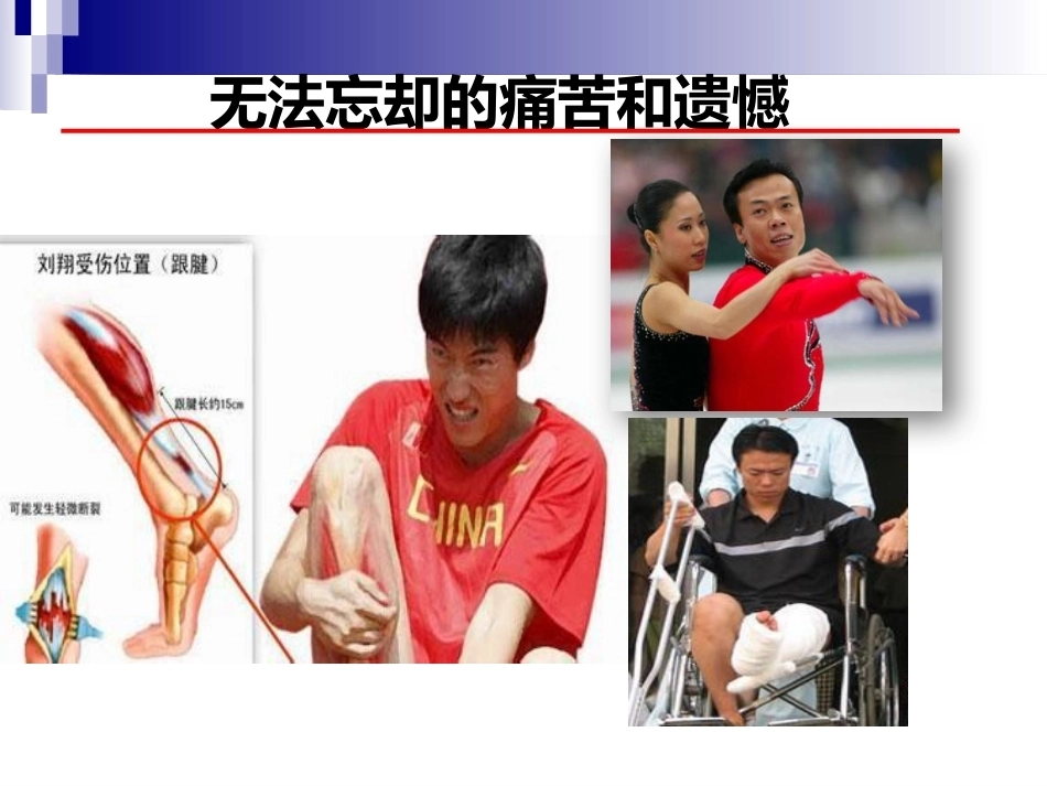 急性跟腱中部断裂的诊 治_第2页