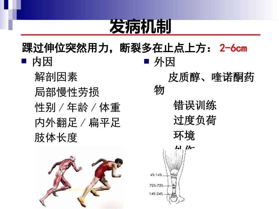 急性跟腱中部断裂的诊 治_第4页