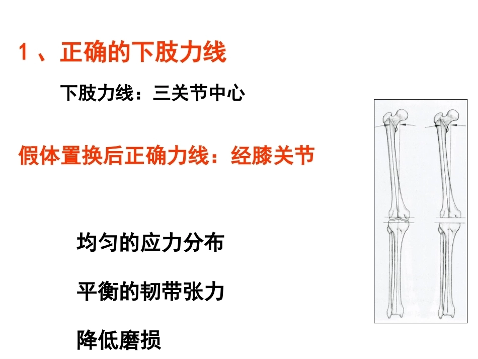 全膝关节置换的 手术原则_第4页