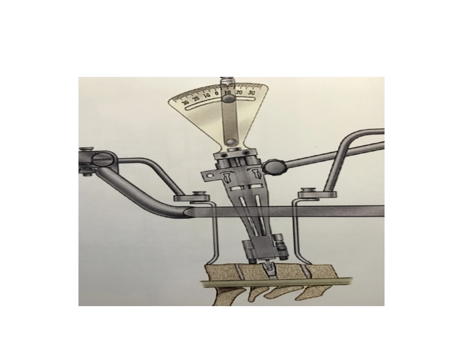 颈椎人工椎间 盘CDR_第10页