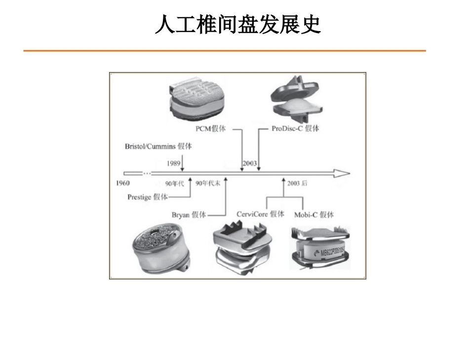 颈椎人工椎间 盘CDR_第4页
