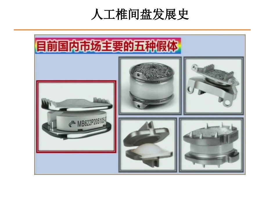 颈椎人工椎间 盘CDR_第5页