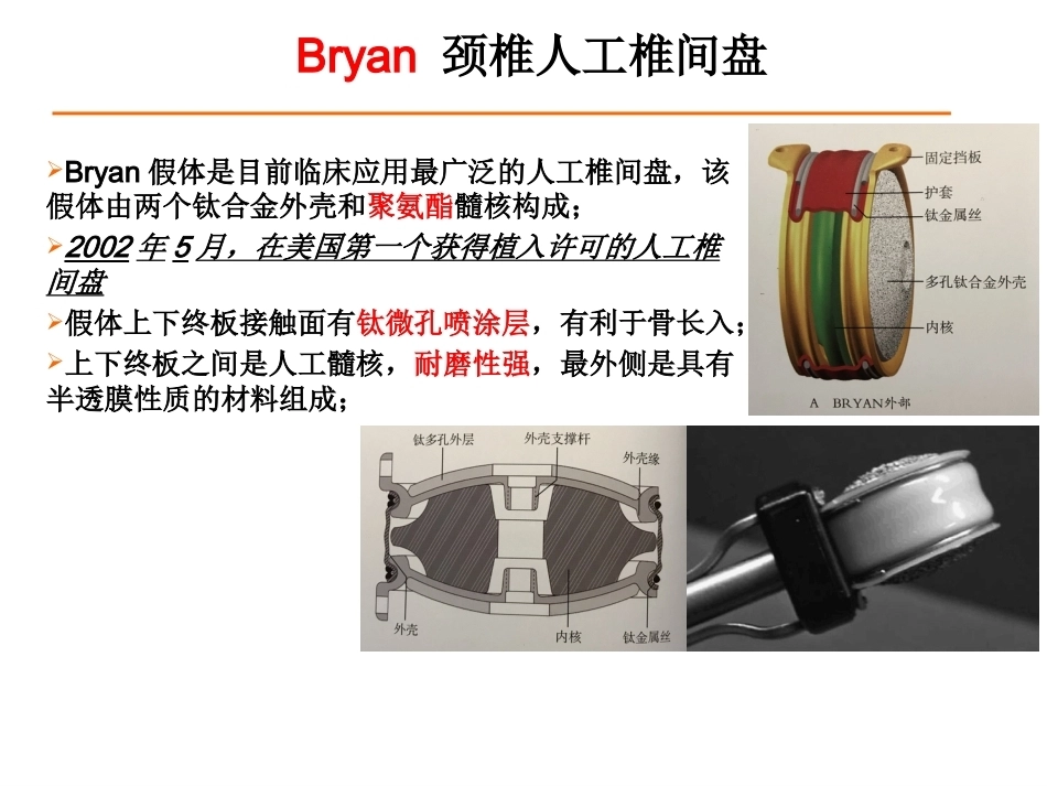 颈椎人工椎间 盘CDR_第6页
