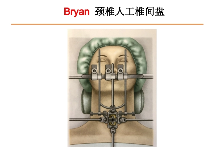 颈椎人工椎间 盘CDR_第9页